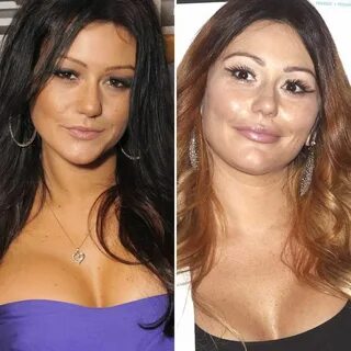 Jwoww Before And After Plastic Surgery : 'Jersey Shore' Cast