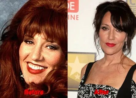 Katey Sagal Plastic Surgery Rumors?