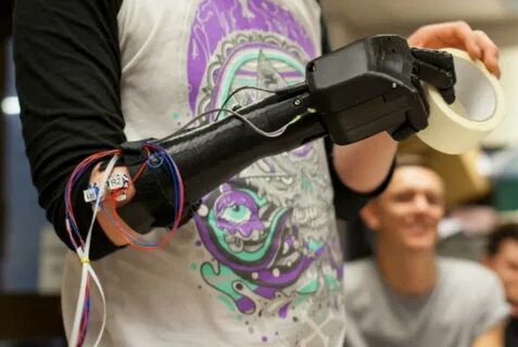 The World's Most Advanced Bionic Hand