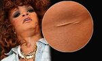 Rihanna reveals mystery chin scar at V Festival