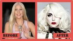 #Gaga #Lady #plastic #surgery Lady Gaga Plastic Surgery Befo