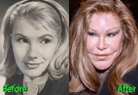 Catwoman Plastic Surgery: From Bad To Worse