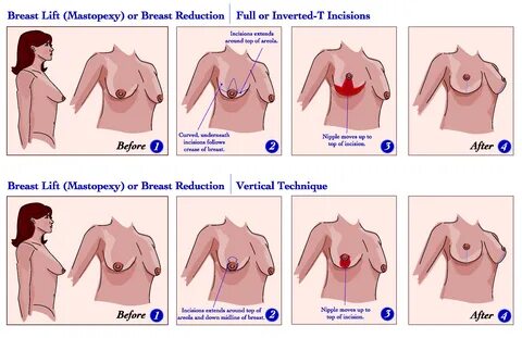 Problems with small boobs