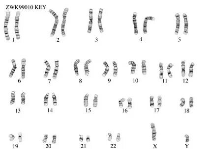 Karyotype - Lessons - Blendspace