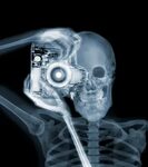A Look at the Creative Work of X-Ray Photographer Nick Vease