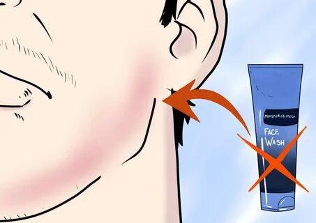 How to Prevent Razor Burn: 14 Steps (with Pictures) - wikiHo