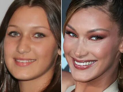 Bella Hadid Before Plastic - Gigi And Bella Hadid Are Famous