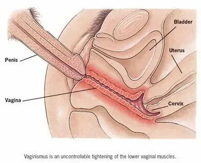 Cervix Penetration By Penis - Telegraph