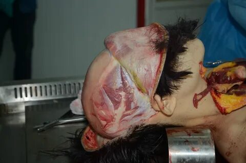 Autopsy of a beautiful Chinese girl whose throat cut - herde