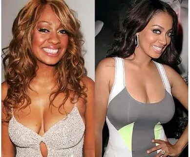 Did LaLa Anthony Opt For Plastic Surgery? Her Comparison Pic