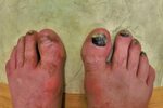 Disgusting Feet Pics - Praceni