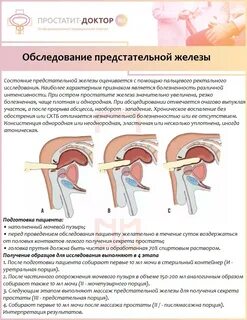 Простатит: что это за заболевание, какие его симптомы и как 