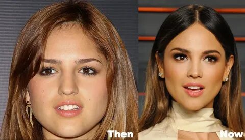 Eiza Gonzalez Plastic Surgery Before and After Photos