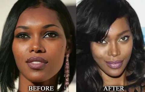 Jessica White Nose Job Before and after - Nose Job Nose job,