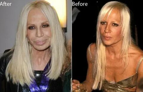 Donatella Versace Before Surgery - cucinadesigns