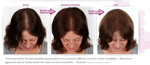 Keranique Review - Hair Regrowth for Women: Does it Really W