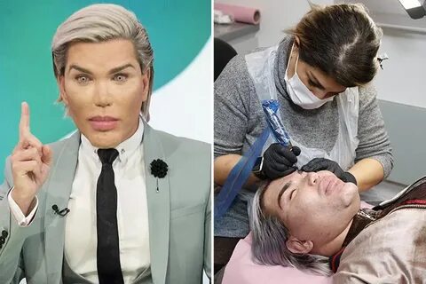 Human Ken Doll Rodrigo Alves forced to get emergency surgery