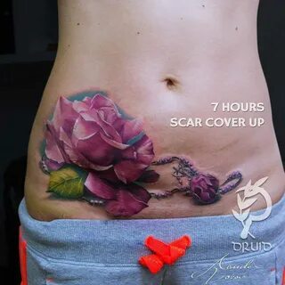 Scar Cover Up Tattoo on Belly Best Tattoo Ideas Gallery