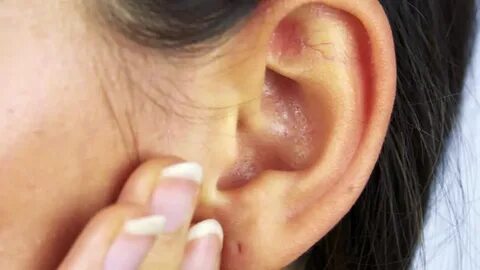 woman feels her ear - closeup: Stockvideók (100%-ban jogdíjm