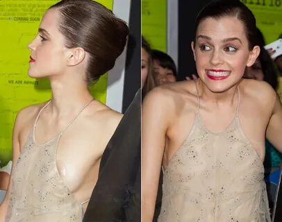 Emma Watson Wardrobe Malfunctions Moments