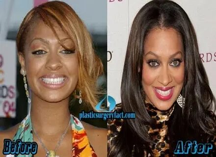 Lala Vasquez Plastic Surgery Before and After Photos Plastic