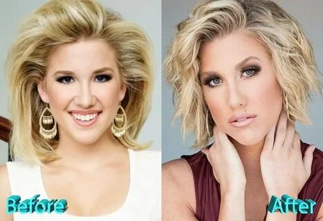 Savannah Chrisley Nose Job