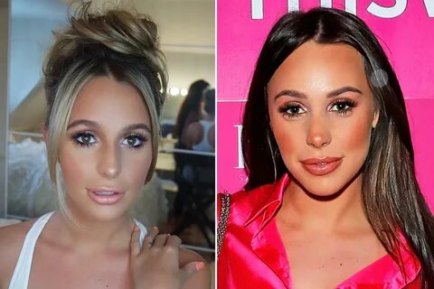 The only way is surgery? 10 TOWIE stars who have ALL had nos