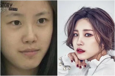 View Ugly Kpop Idols Without Makeup Pics - Idol