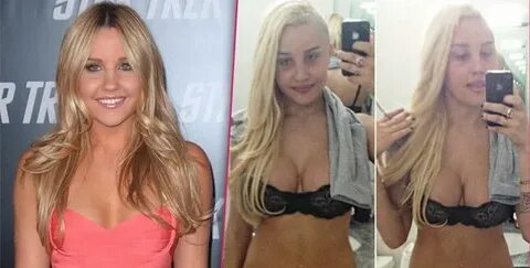 Amanda Bynes: 'I Got My Breast Implants Removed'