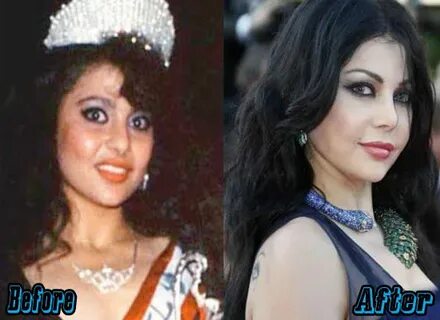 Haifa Wehbe Plastic Surgery Before and After - Plastic Surge