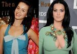 Katy Perry Plastic Surgery, Before and After Boob Job Pictur