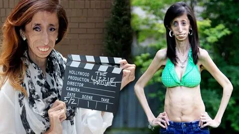 Skinniest Woman In The World Named "World’s Ugliest Woman" -