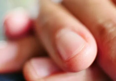6 Things Your Nails Say About Your Health - Cleveland Clinic