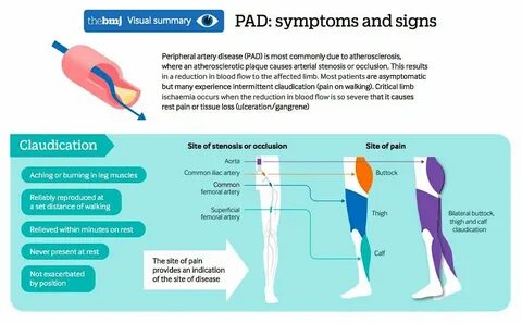 Vascular Protection в Твиттере: "#PeripheralArteryDisease: s