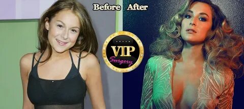 Alexa Vega Plastic Surgery Before and After Photos