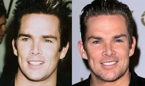 Mark McGrath before and after plastic surgery (9) Celebrity 