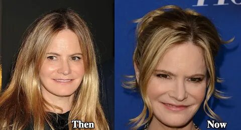 Jennifer Jason Leigh Plastic Surgery Before and After Photos