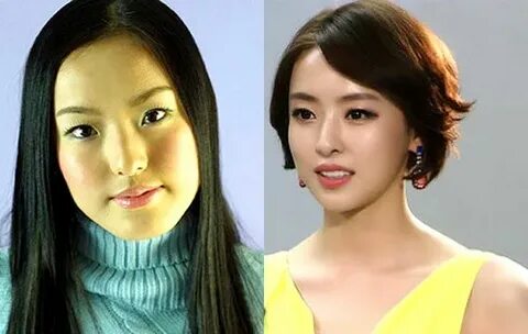 Lee Da Hee Plastic Surgery / Did she go under the knife like