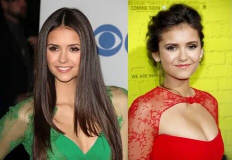 Nina Dobrev Plastic Surgery Before And After Nose Job Photos