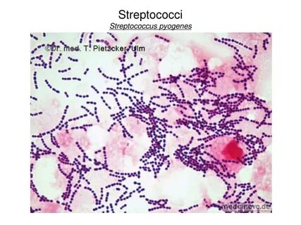 PPT - Diplococci Neisseria gonorrhoeae PowerPoint Presentati