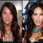 Megan Fox Before After Plastic Surgery Photos - Celebrity Pl