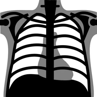 X Ray png clipart PNG All