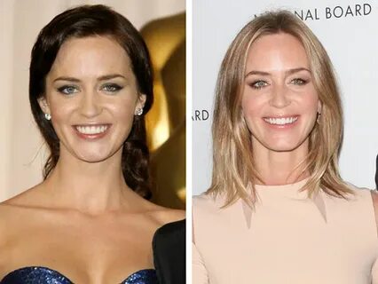 Emily Blunt Plastic Surgery Before & After - Celebrity Plast