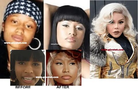 Nicki Minaj Before Plastic Surgery(Rapper, Singer, Writer, M
