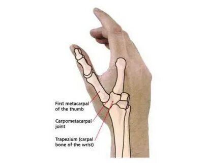 Pictures Of Carpometacarpal Joint Of The Thumb