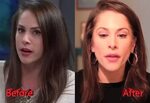 Ana Kasparian Nose Job: Before and After