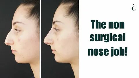 The non surgical nose job! - YouTube