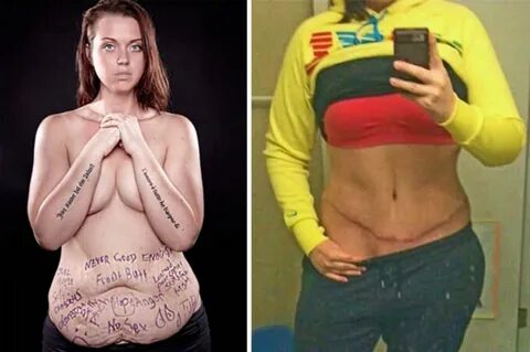 Weight Loss Before And After Hot Woman Free Porn