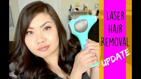 Laser Hair Removal UPDATE Before & After - YouTube