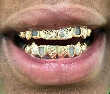 Custom Grillz Gold Grillz Diamond Grillz Custom Jewelry